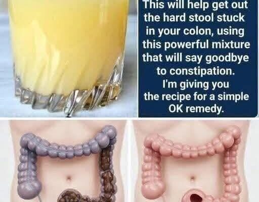🍋 Cleansing & Natural Constipation Relief Drink ✨